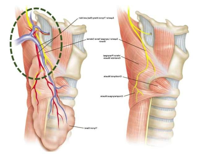 Thyroid Surgery Step 6 Superior Pole